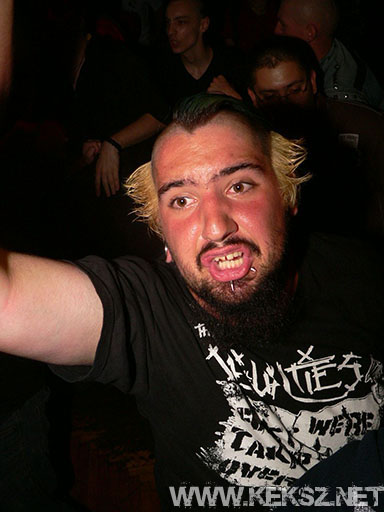 090716-1154-kateter.jpg